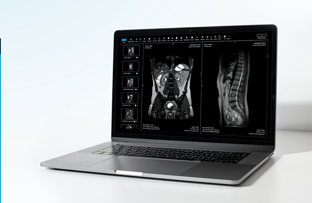 PACS o que e como utilizado na Radiologia Blog Medcloud