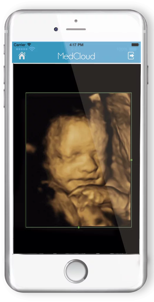 iphone-medcloud-ultrassom-baby